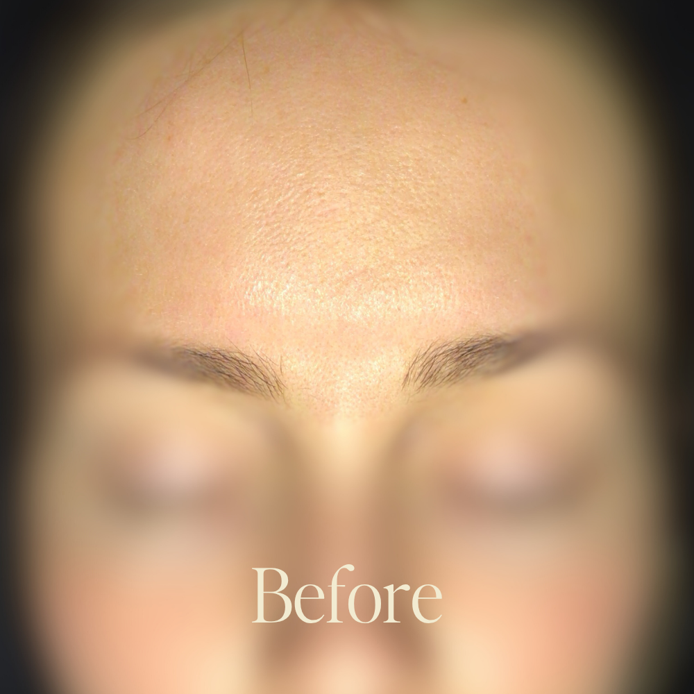 Genaura Dryness Before and After 1