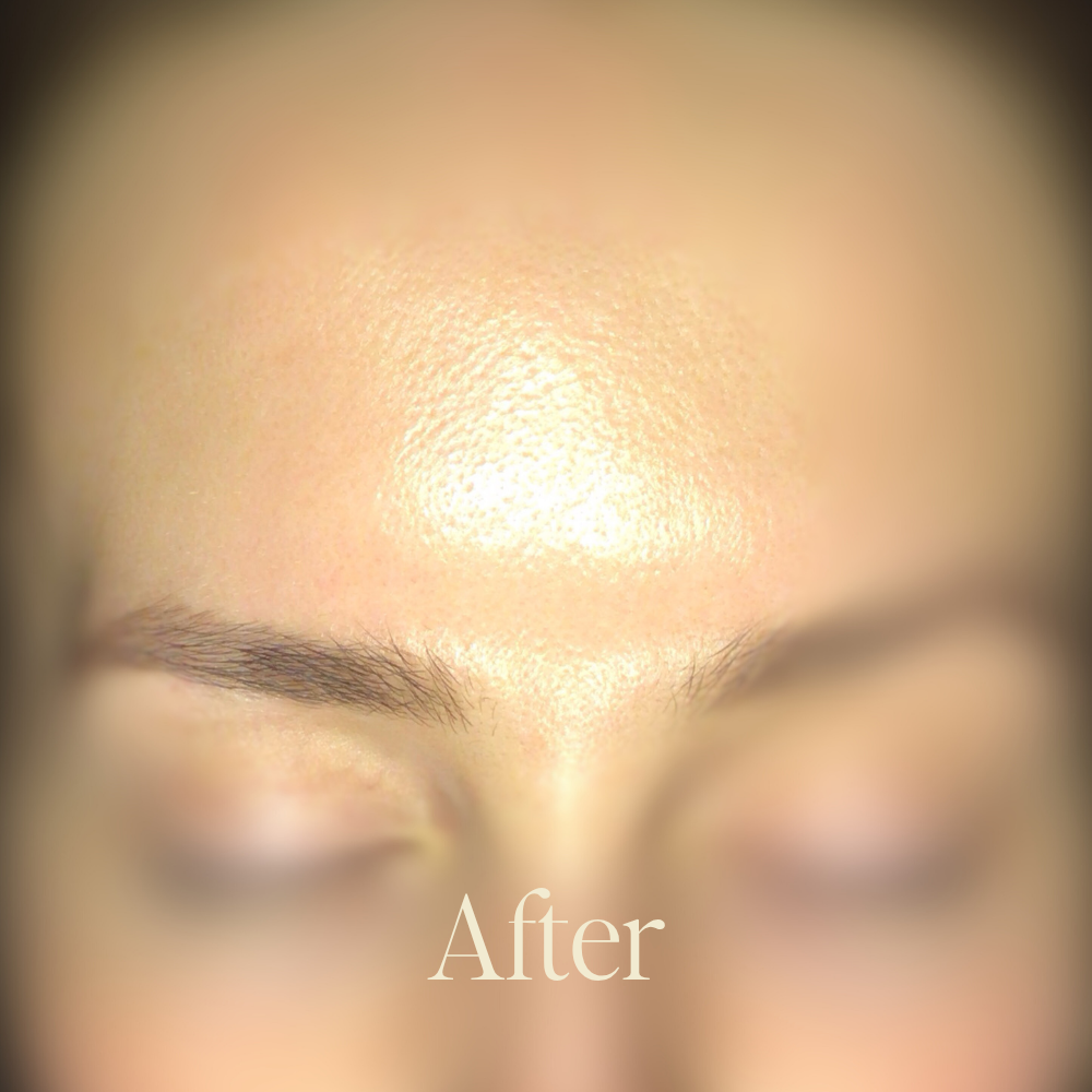 Genaura Dryness Before and After 2