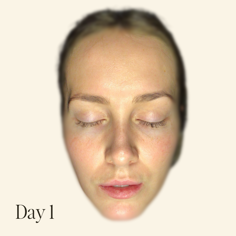 Genaura levagen+ Results Reduces dryness & dullness Shrink 1