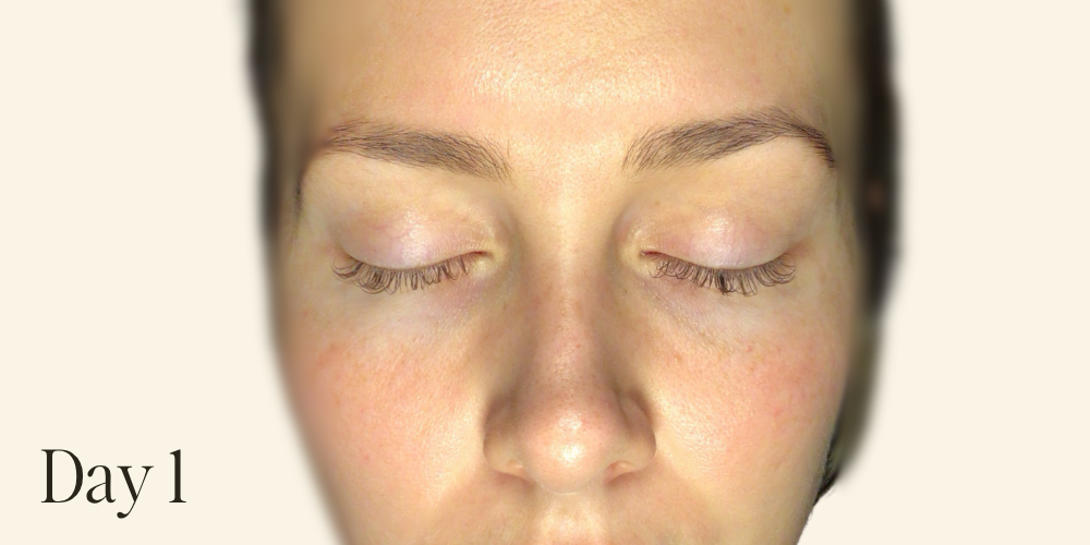 Genaura levagen+ Results zoom 3