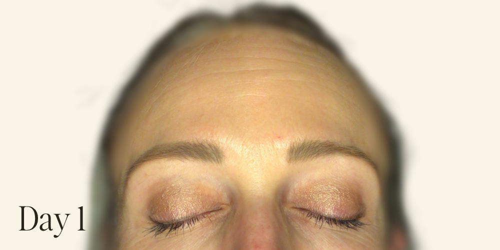 Genaura levagen+ Results zoom 5